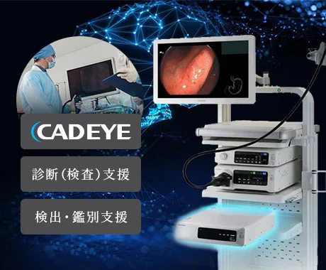 内視鏡画像診断支援システム：CAD EYE